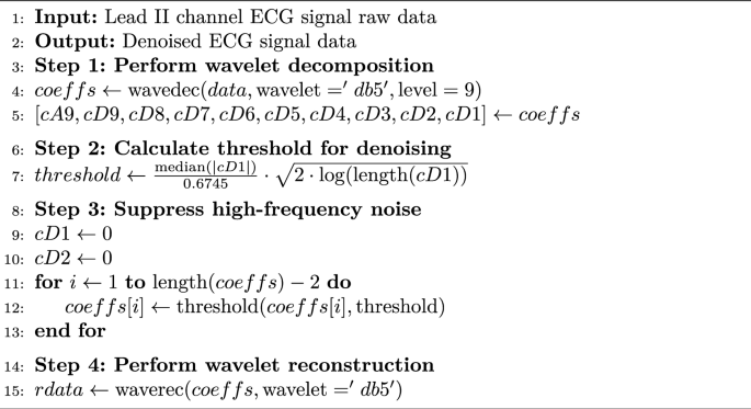 Ecg-based arrhythmia classification using discrete wavelet transform ...