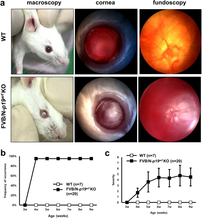 Differential manifestation of ocular phenotypes in TALEN-mediated p19arf  knockout FVB/N and C57BL/6J mouse lines | SpringerLink
