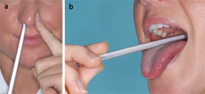 Diagnose von Mundgeruch mittels Halimeter® - Zahnarztpraxis Dr