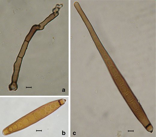 helminthosporium rostratum a parazitáktól a felnőttekig