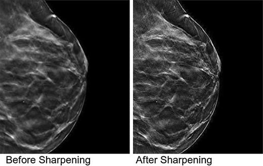 Sharpness Improvement for Medical Images Using a New Nimble Filter |  SpringerLink