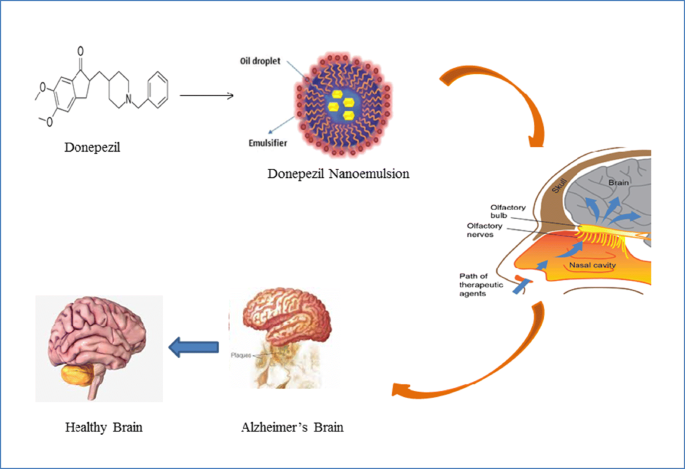 Treatment of Alzheimer's diseases using donepezil nanoemulsion: an  intranasal approach | SpringerLink