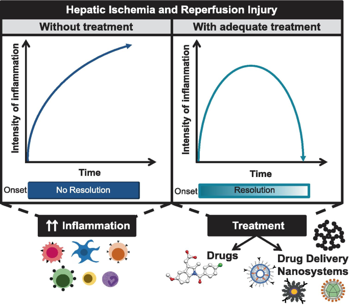 Drug delivery nanosystems targeted to hepatic ischemia and reperfusion  injury | SpringerLink