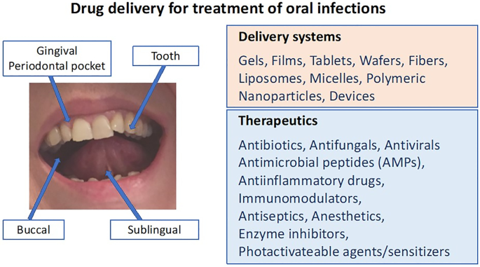 Current Status And Future Of Delivery Systems For Prevention And Treatment Of Infections In The Oral Cavity Springerlink Current Status And Future Of Delivery Systems For Prevention And Treatment Of Infections In The Oral Cavity Springerlink