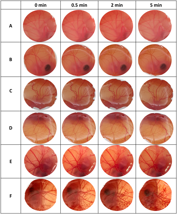 Rapidly dissolving bilayer microneedles enabling minimally invasive and  efficient protein delivery to the posterior segment of the eye |  SpringerLink