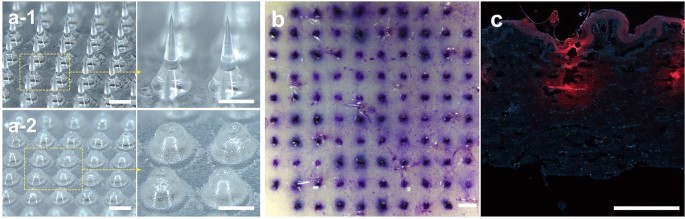 pure glp-1 nano microneedle patch Microneedle patch with pure drug tips for delivery of liraglutide:  pharmacokinetics in rats and minipigs | Drug Delivery and Translational  Research