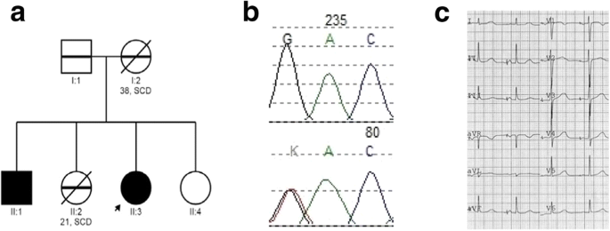 Identification Novel Lqt Syndrome Associated Variants In Polish Population And Genotype Phenotype Correlations In Eight Families Springerlink