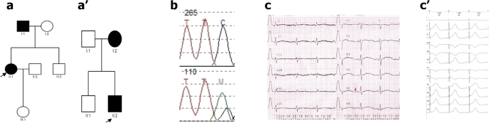 Identification Novel Lqt Syndrome Associated Variants In Polish Population And Genotype Phenotype Correlations In Eight Families Springerlink