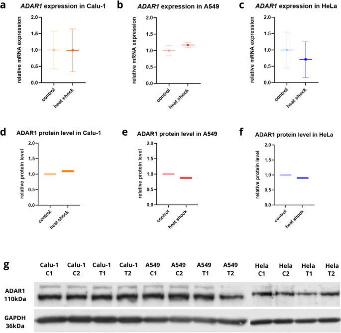 ADAR1 expression in different cancer cell lines and its change under ...