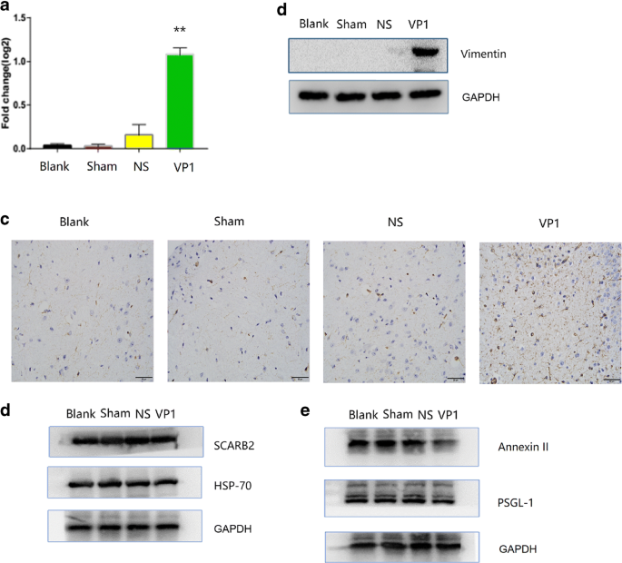 Enterovirus 1 Capsid Protein Vp1 Increases Blood Brain Barrier Permeability And Virus Receptor Vimentin On The Brain Endothelial Cells Springerlink