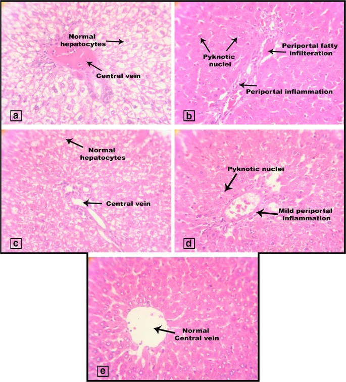 Administration Of Coenzyme Q10 To A Diabetic Rat Model Changes In Biochemical Antioxidant And Histopathological Indicators Springerlink