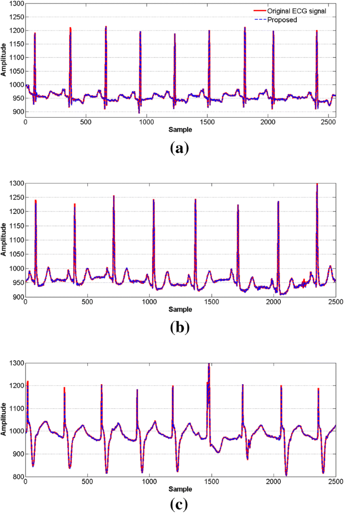 A Compressed Sensing Based Compressor For Ecg Springerlink