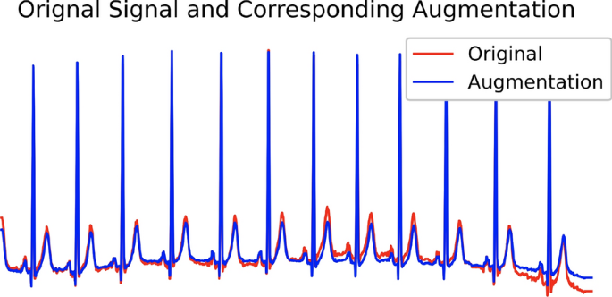 Graph structure based data augmentation method | Biomedical Engineering ...