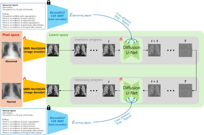 Generative AI for developing foundation models in radiology and imaging ...