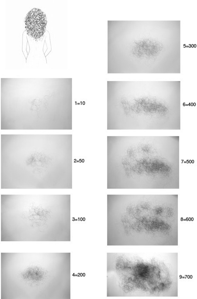 The Hair Shedding Visual Scale: A Quick Tool to Assess Hair Loss in Women |  SpringerLink