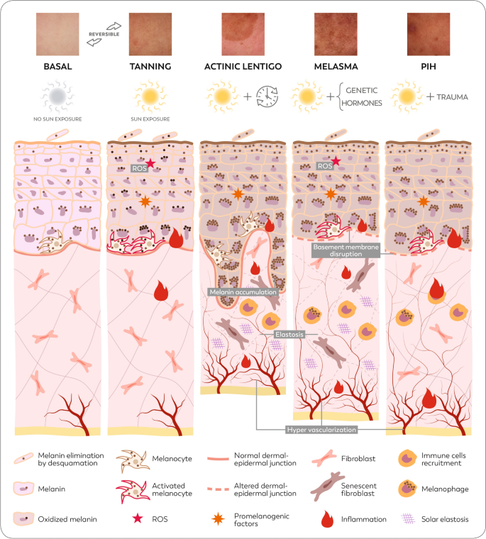 melanotan 2 nausia Melanotan II - an overview