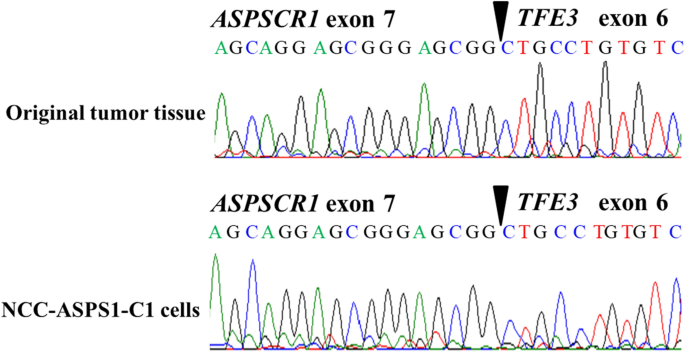 Establishment And Characterization Of Ncc Asps1 C1 A Novel Patient Derived Cell Line Of Alveolar Soft Part Sarcoma Springerlink