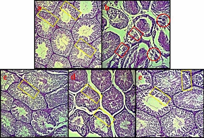 Properties of Solanum melongena green calyx against toxic effects 