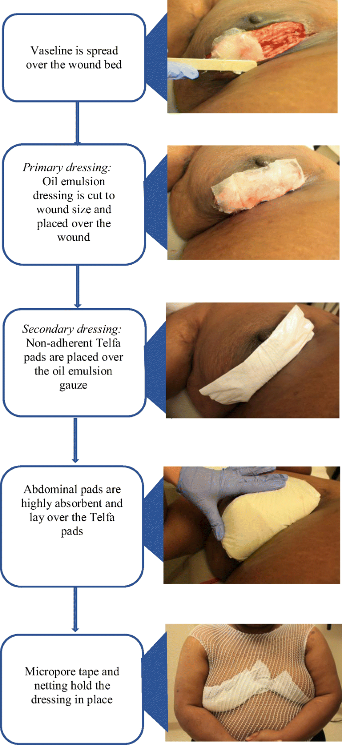 Recent development of electrospun wound dressing - ScienceDirect