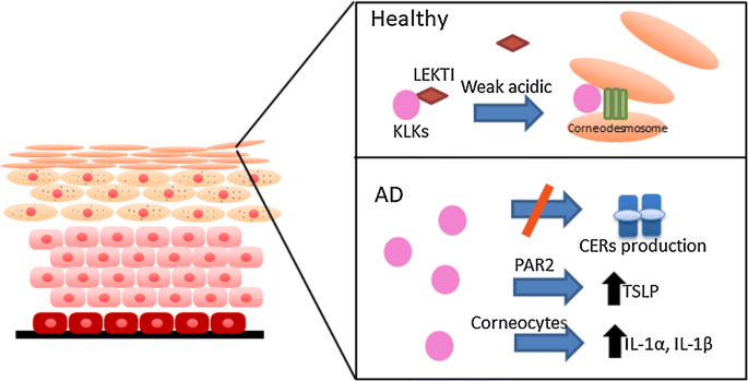 Skin Barrier Function And Atopic Dermatitis Springerlink