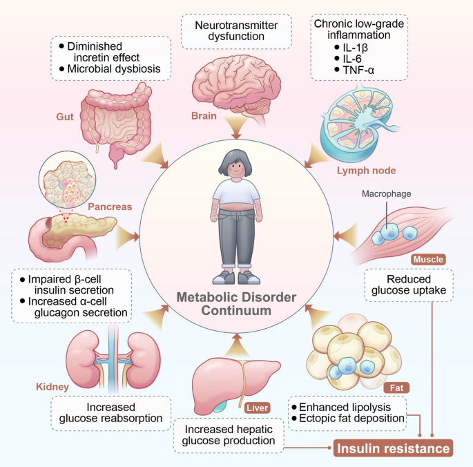 Beyond Discrete Diagnoses: Conceptualizing Obesity-associated Metabolic ...