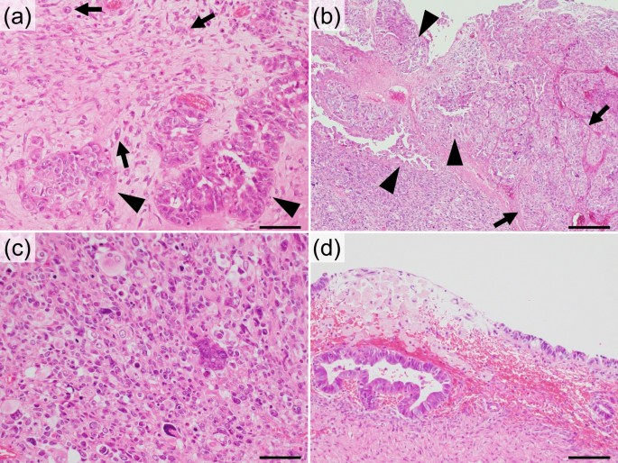 Ovarian of heterologous type occurring in an