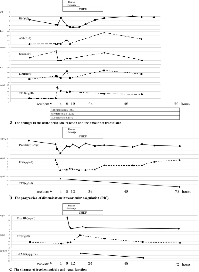 A case of ABO-incompatible blood transfusion treated by plasma exchange therapy and continuous hemodiafiltration | SpringerLink A case of ABO-incompatible blood transfusion treated by plasma exchange therapy and continuous hemodiafiltration | SpringerLink