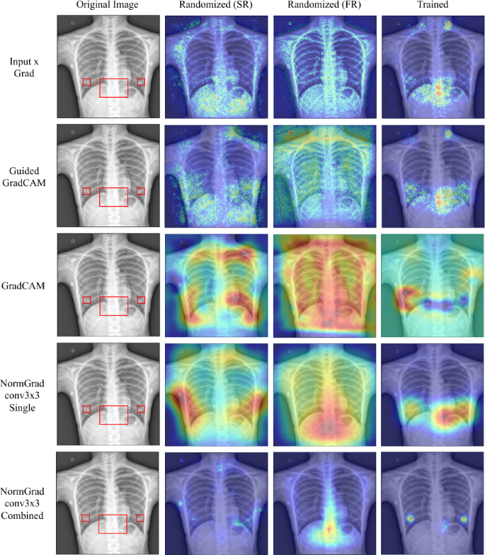 Consistent explainable image quality assessment for medical imaging ...