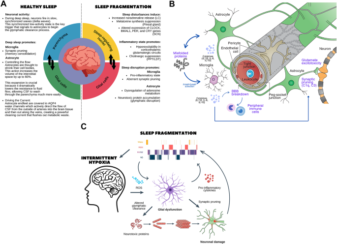 When sleep fails, brain clearance suffers: the role of glymphatic ...