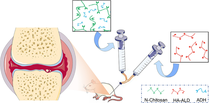 Intra Articular Injection Of Chitosan Based Supramolecular Hydrogel For Osteoarthritis Treatment Springerlink