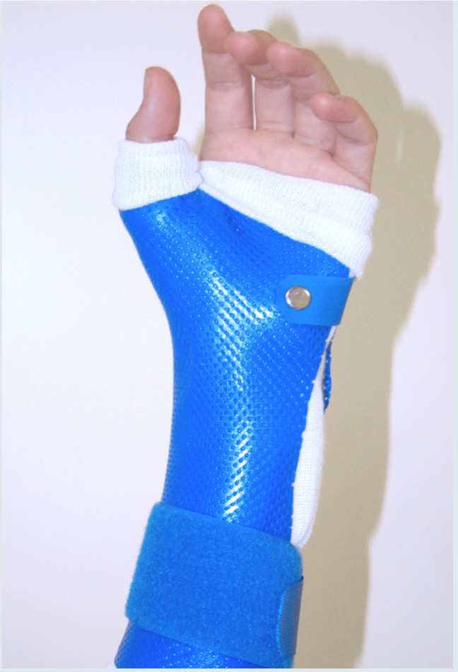 Frühfunktionelle Nachbehandlung von Hand- und Fingerverletzungen |  SpringerLink