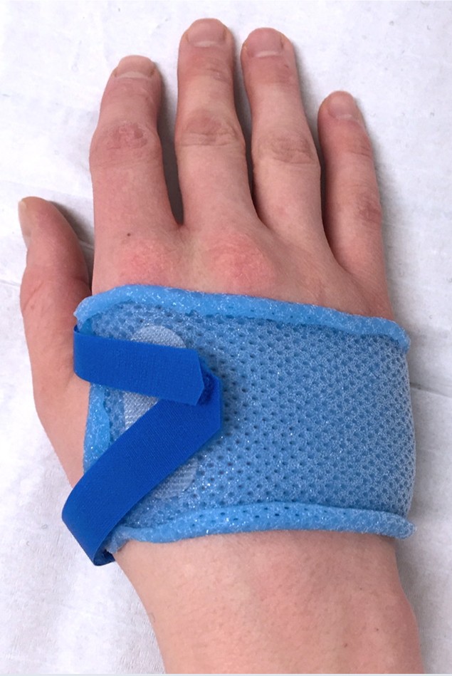 Frühfunktionelle Nachbehandlung von Hand- und Fingerverletzungen |  SpringerLink