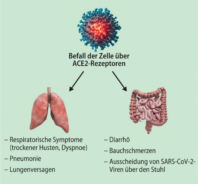 Wie das Coronavirus den Magen-Darm-Trakt angreift | SpringerLink