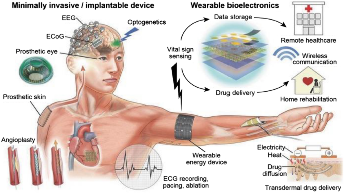essay on medical devices figure 2