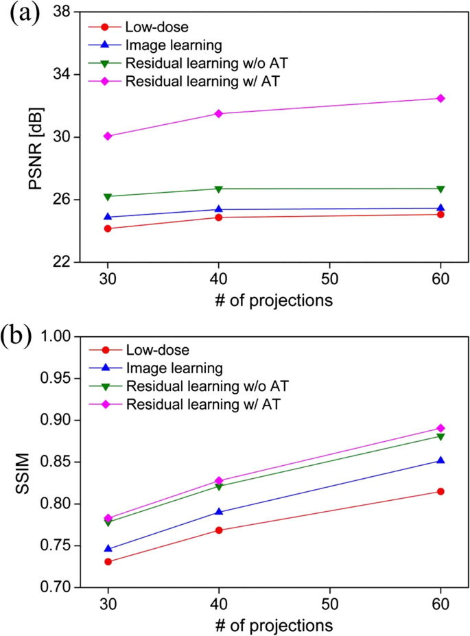 Deep residual learning with Anscombe transformation for low-dose ...