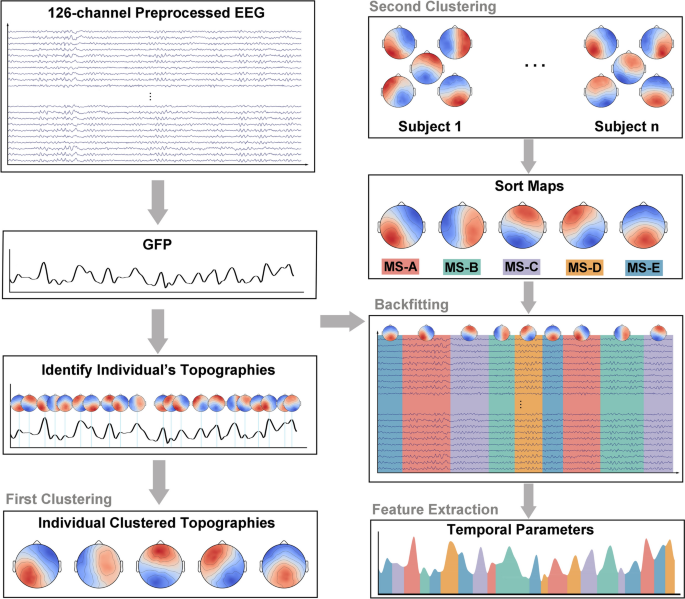 Pulsed Radiofrequency Analgesia Alters EEG Spatiotemporal Dynamics: A ...