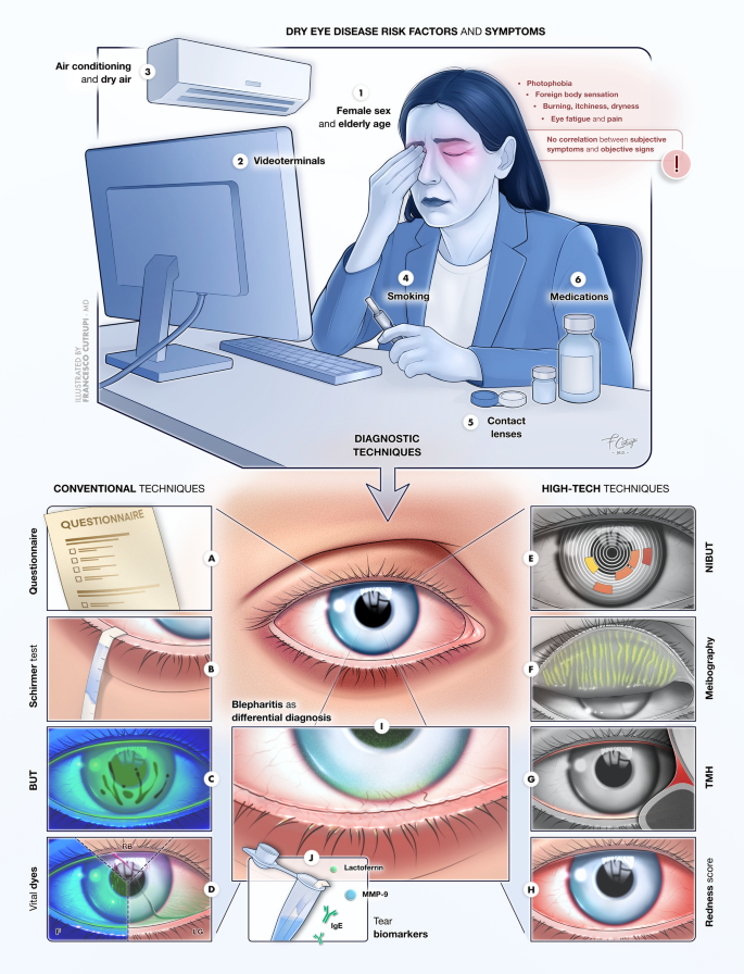 acetyl l-carnitine for dry eye Multifaceted mitochondrial as a novel therapeutic target in eye: insights and interventions Dry Eye Disease: From Causes