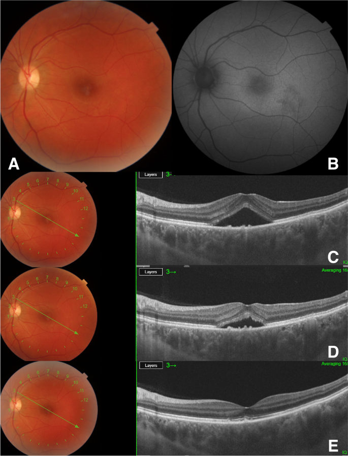 Fig. 2