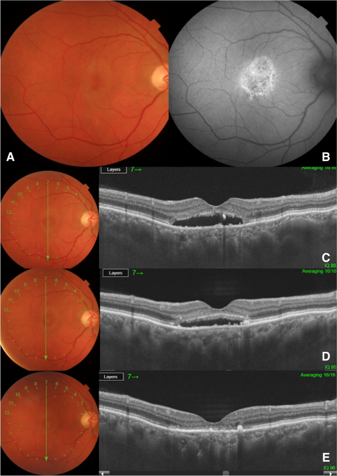 Fig. 3