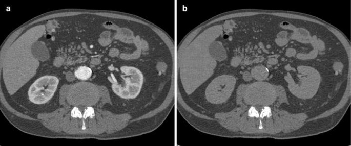 figure 24