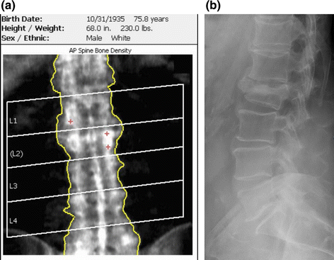 figure 14