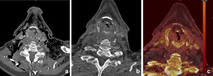 figure 15