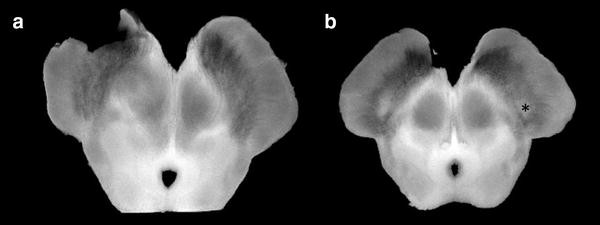 Imaging Parkinsonian Pathology In Substantia Nigra With Mri Springerlink