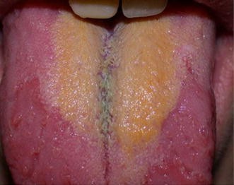 how does chewing tobacco make you feel Chewing Tobacco and Its Harmful Effects on Oral Health