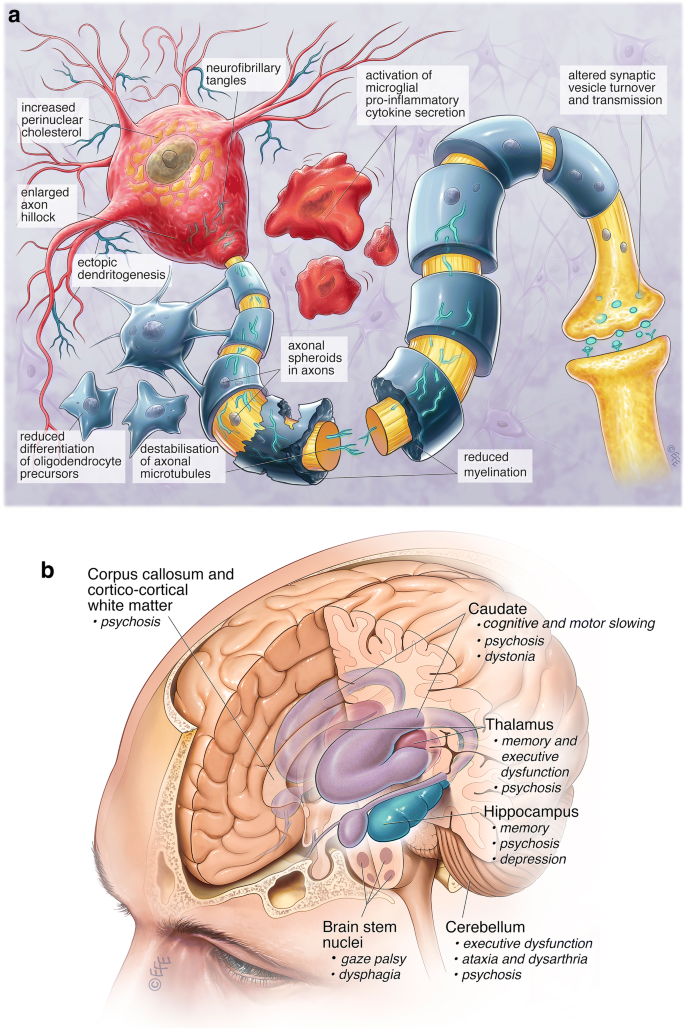 Lipid trafficking defects in Niemann-Pick type C disease