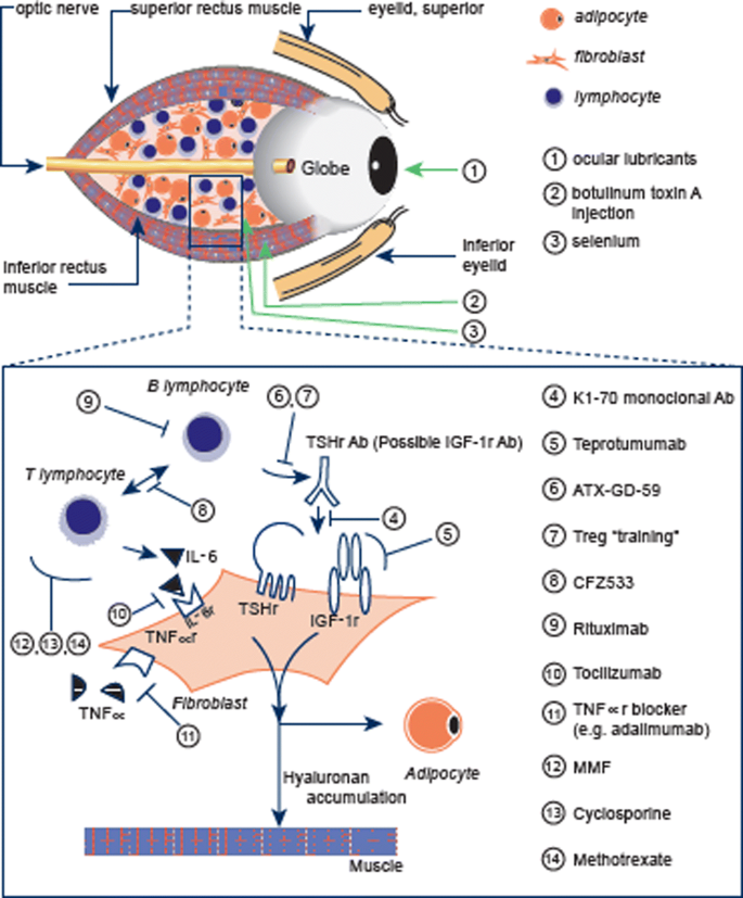 Statins for Graves' orbitopathy (STAGO): a phase 2, open-label, adaptive,  single centre, randomised clinical trial - The Lancet Diabetes &  Endocrinology