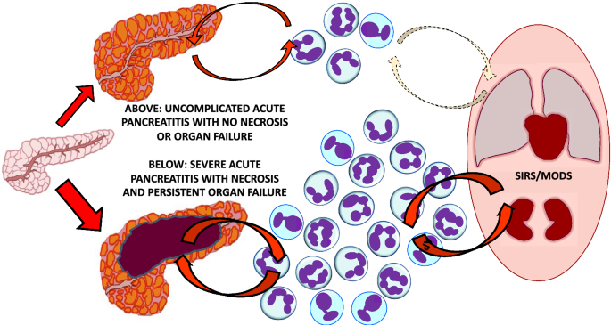 semaglutide aspiration case report anesthesia 2023 Semaglutide and delayed gastric emptying: case report and analysis of  anesthetic implications