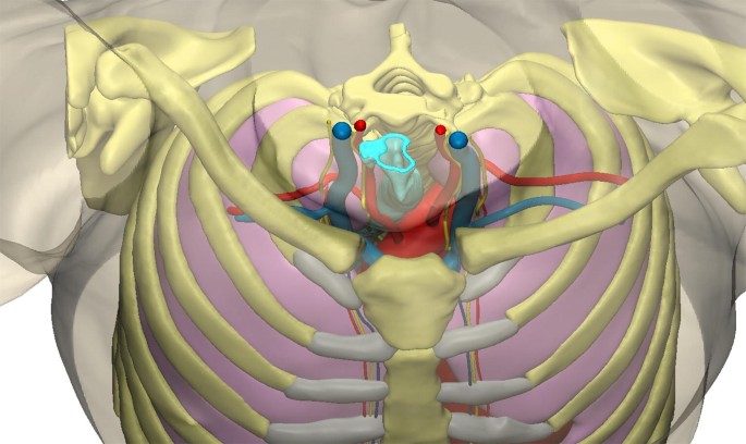 Sternal Injuries In Sport A Review Of The Literature Springerlink