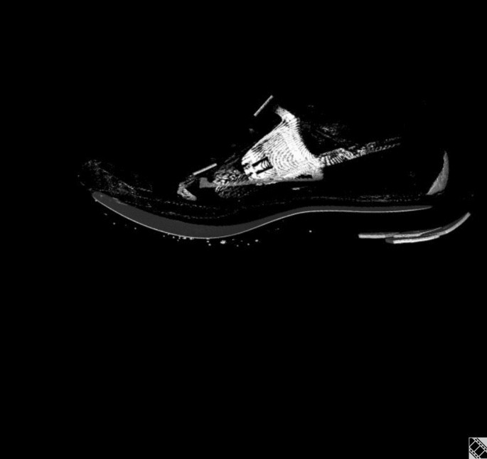 new balance 578 womens 2016