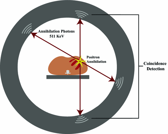 PET myocardial perfusion quantification: anatomy of a spreading functional  technique | SpringerLink